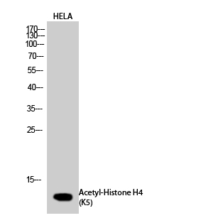 Histone H4K5ac (Acetyl H4K5) Polyclonal Antibody