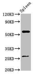 ACD Polyclonal Antibody
