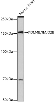 KDM4B Polyclonal Antibody