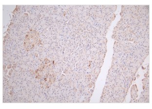 GCN5 Polyclonal Antibody
