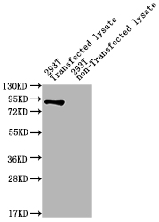 ureB Polyclonal Antibody
