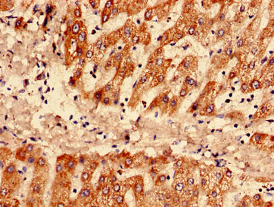 SAA1 Polyclonal Antibody