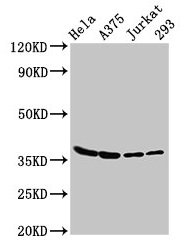 LDHA Polyclonal Antibody