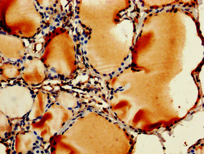 RPL11 Polyclonal Antibody