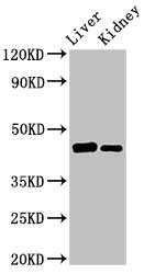 GALT Polyclonal Antibody