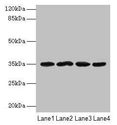METRNL Polyclonal Antibody