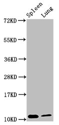 S100a8 Polyclonal Antibody