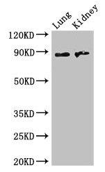 NAALADL2 Polyclonal Antibody