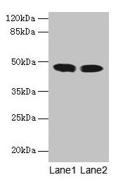 ACADL Polyclonal Antibody