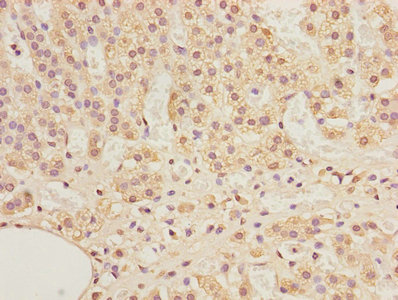 ADAMDEC1 Polyclonal Antibody