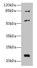 PYHIN1 Polyclonal Antibody