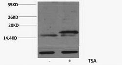 Histone H3K36ac (Acetyl H3K36) Polyclonal Antibody