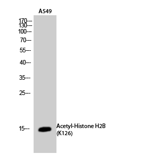 Histone H2BK126ac (Acetyl H2BK126) Polyclonal Antibody