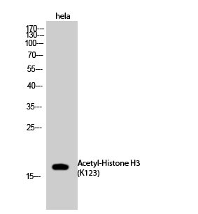Histone H3K123ac (Acetyl H3K123) Polyclonal Antibody