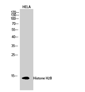 Histone H2B Polyclonal Antibody