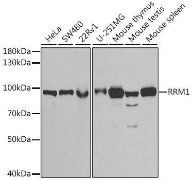 RRM1 Polyclonal Antibody