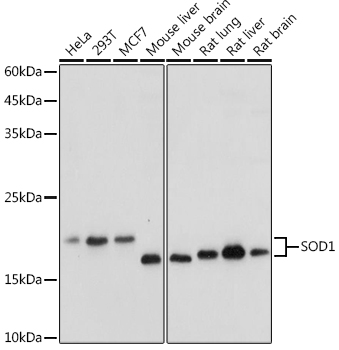 SOD1 Polyclonal Antibody