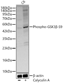 Phospho-GSK3B-S9 Polyclonal Antibody
