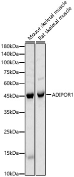 ADIPOR1 Polyclonal Antibody