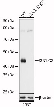 SUCLG2 Polyclonal Antibody