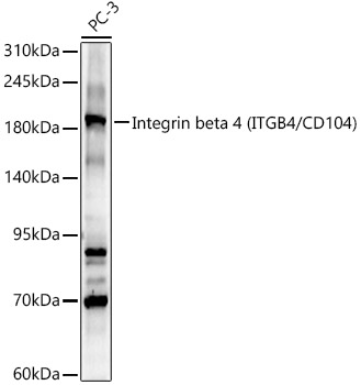 ITGB4 Polyclonal Antibody