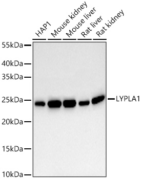 LYPLA1 Monoclonal Antibody [9R8T5]