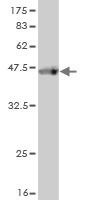 ABCF2 Monoclonal Antibody [1D11]