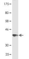 JMJD1C Monoclonal Antibody [3A8]
