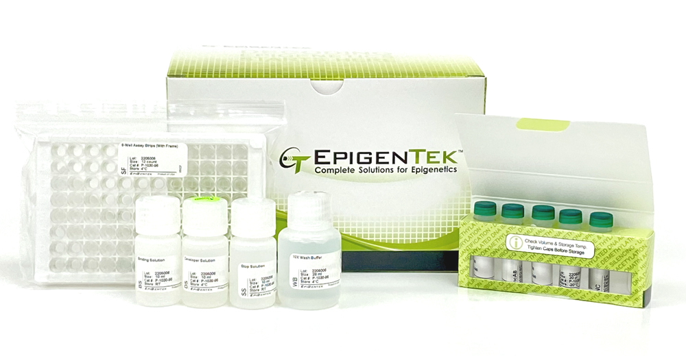 5-methylcytosine ELISA Kit for Global DNA Methylation Analysis  (Colorimetric)