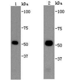 B-tubulin Monoclonal Antibody [A1-A4]