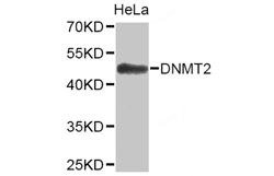 DNMT2 Polyclonal Antibody