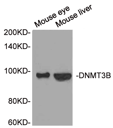 DNMT3B Polyclonal Antibody