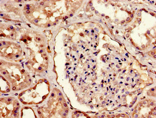 MBD1 Polyclonal Antibody