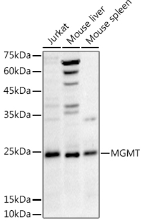 MGMT Polyclonal Antibody