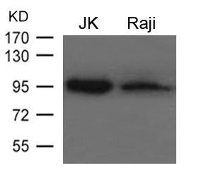 PRDM1 Polyclonal Antibody