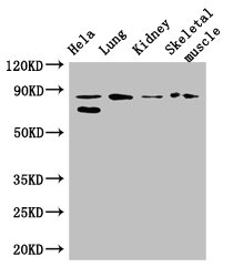 PRDM4 Polyclonal Antibody