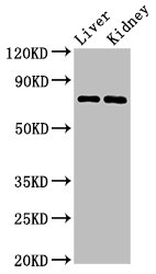 PRDM5 Polyclonal Antibody