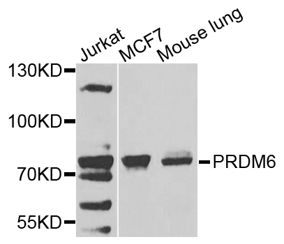 PRDM6 Polyclonal Antibody