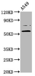 PRDM11 Polyclonal Antibody