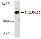 PRDM15 Polyclonal Antibody