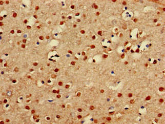 PRDM16 Polyclonal Antibody