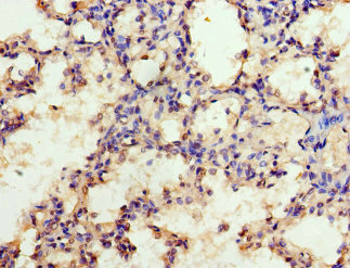 EZH1 Polyclonal Antibody
