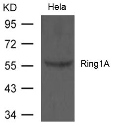 RING1 Polyclonal Antibody