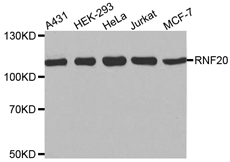RNF20 Monoclonal Antibody