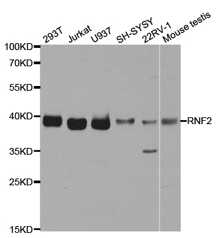 RNF2 Polyclonal Antibody