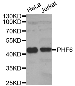PHF6 Polyclonal Antibody