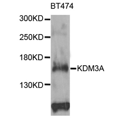 KDM3A Polyclonal Antibody