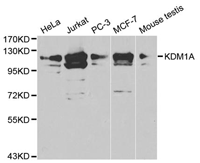KDM1A Polyclonal Antibody