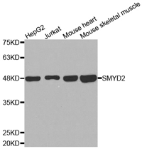 SMYD2 Polyclonal Antibody