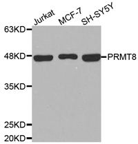 PRMT8 Polyclonal Antibody